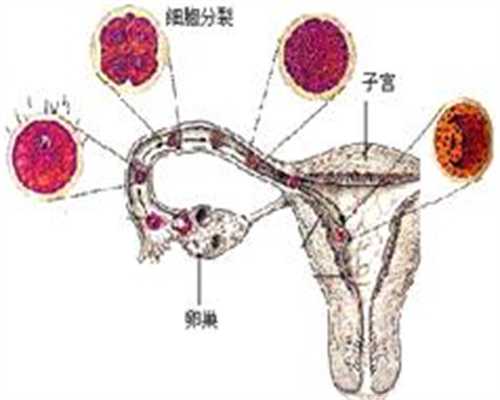 中国广州代孕中心_孕妇吃雪糕有哪些危害 容易引发腹痛情况