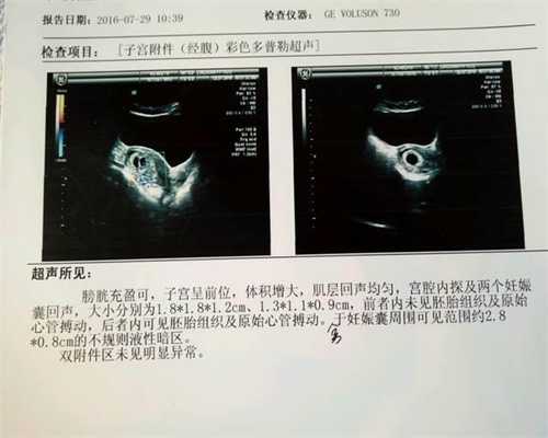 广州2020年代孕孩子_什么是妊娠早期绒毛活检？