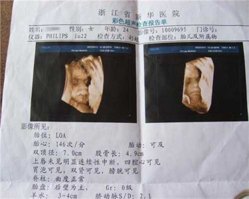 广州代孕医院服务价格_10~12个月宝宝食谱
