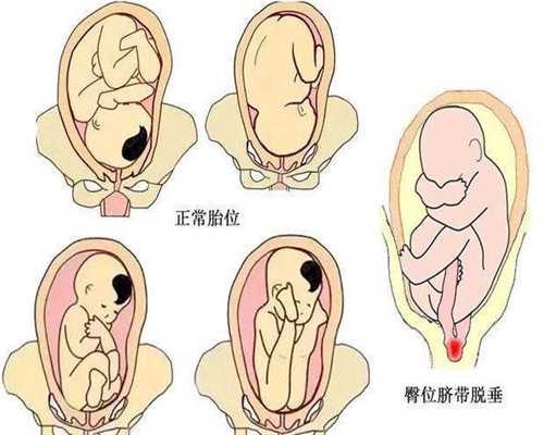广州代怀孕2020郑州价格_怎样可以检查宫腔粘连