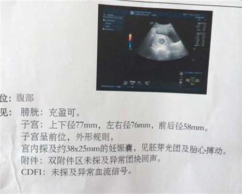 广州代孕一般费用是多少_轻松使用纸尿裤或布尿片（中）