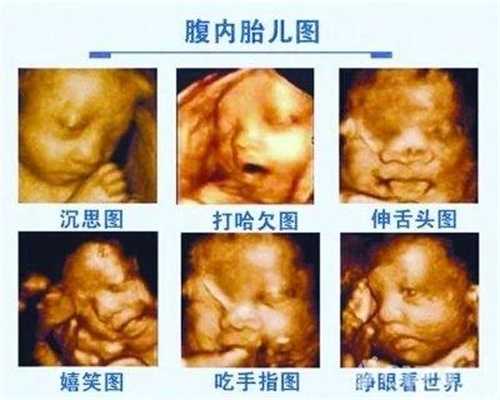 广州代怀生子_孕早期如果胎停会有什么症状
