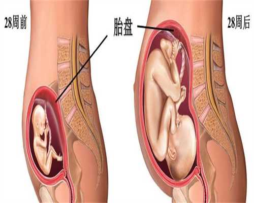 广州代孕代怀孕包性别多少钱_胎教仪器对胎儿有影响吗