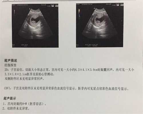 广州代怀包出生流程_高龄产妇如何备孕