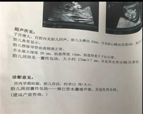 广州代孕公司排名_第一次产检要注意哪些事情