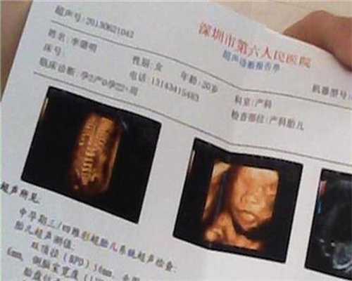 广州代孕费用是多少钱_胎心监护异常怎么办-