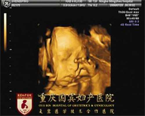 广州代怀孕生殖中心_孕妇先兆流产有哪些症状？