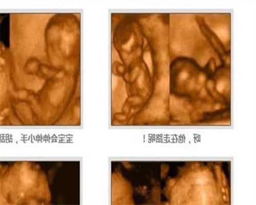 广州找代孕怎么付款_女性如何防止习惯性流产？