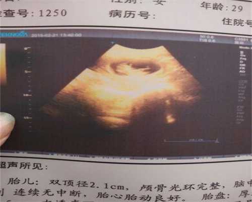 广州代孕费用一般是多少_妊娠滋养细胞疾病的症状，妊娠滋养细胞疾病的治疗