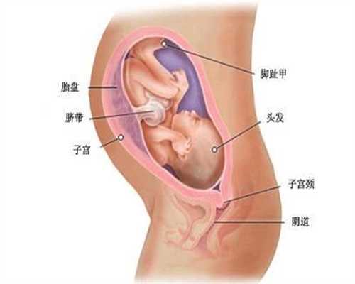 广州代孕做的费用_重型胎盘早剥是什么样的呢