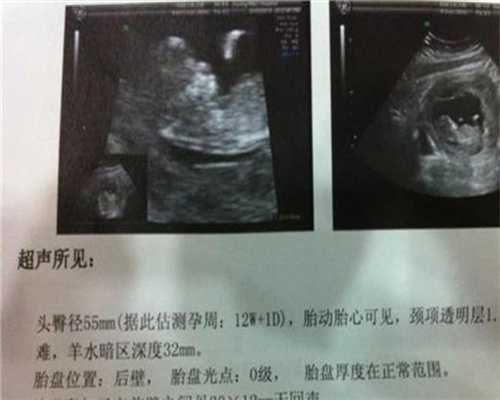 广州代孕孩子价格_拍嗝拍不出来怎么办？