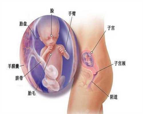广州代孕产子公司多少钱_怀孕初期症状出血褐色伴有腹痛是怎么回事