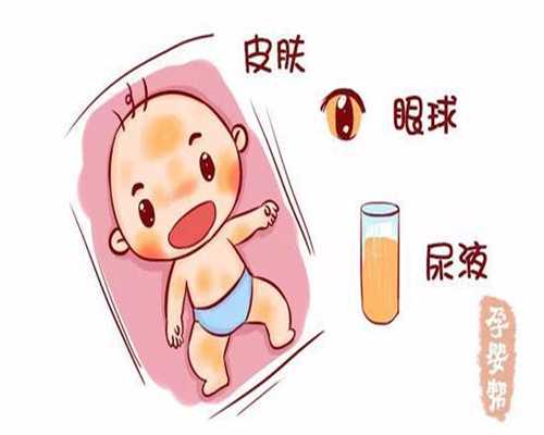 广州代生宝宝助孕机构价格表_孕吐嗓子疼怎么办呢