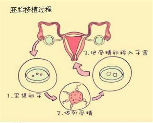 广州专业代孕网_宝宝肠鸣音亢进的原因有哪些？