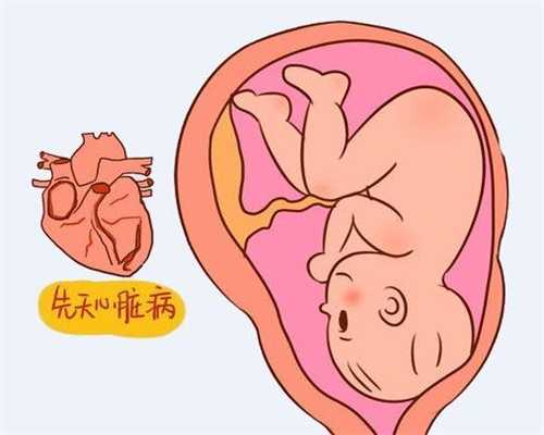 广州代孕产子中心_怀孕痉挛怎么办