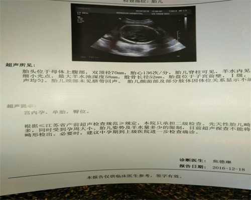 广州正规代孕网服务中心_怎样避免开学后的不适应症