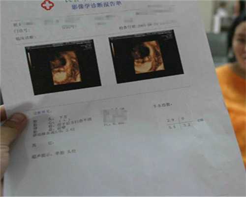 广州代孕成功率_医院代孕_最新代孕技术