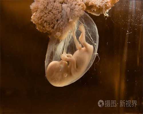 广州代孕咨询_济南可靠代孕公司_济南正规的代孕