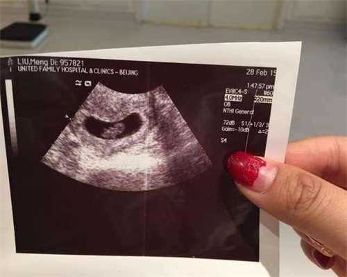 广州代孕医生咨询_代孕宝宝包男孩_代孕孩子有哪些方式
