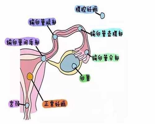 广州代孕在线咨询_代孕儿子生殖_代孕儿子包男孩